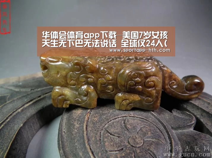 华体会体育app下载-美国7岁女孩天生无下巴无法说话 全球仅24人(图)(图1) 华体会官方网站入口